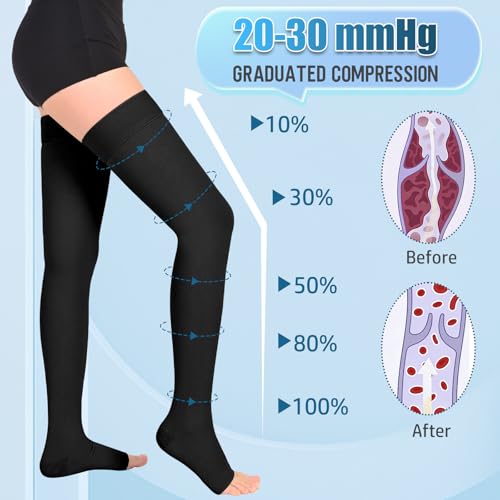 Athbavib 20-30 mmHg Thigh High Compression Stockings for Women Men - color: Open Toe-Black, size: Large