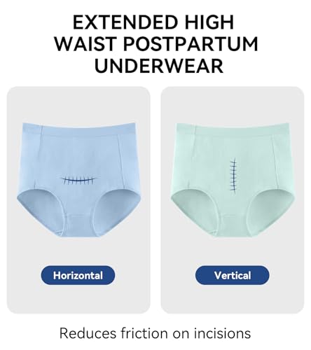 OLIKEME Womens Cotton Underwear High Waisted Postpartum C Section Panties Soft Stretch Breathable Full Coverage Briefs 6 Pack - color: Multicolor,6pack, size: X-Large