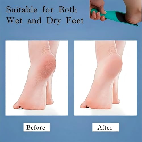 U-Shaped Curved Foot File Dead Skin Callus Remover Scrubber