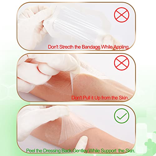 NeuHeils Transparent Film Dressing, 2 3/8x2 3/4 Inch, 100 Pack, Waterproof - size: 2 3/8" x 2 3/4"