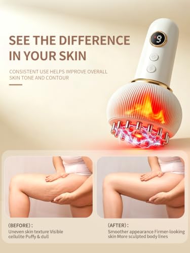 Lymphatic Drainage Massager & Anti Cellulite Massage Tool, Helps Reduce Stretch Marks & Cellulite, for Legs, Arms & Belly, Body Sculpting Machine with Light, Heat & Vibration-G08