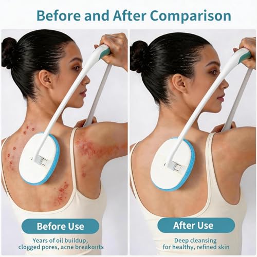 Back Scrubber for Shower, Full Body Shower Brush for Body, L-Shaped Foldable Long Handle, 2-in-1 Dual Purpose Back Scrubber, Suitable for The Elderly & Sensitive Skin - color: Blue+white