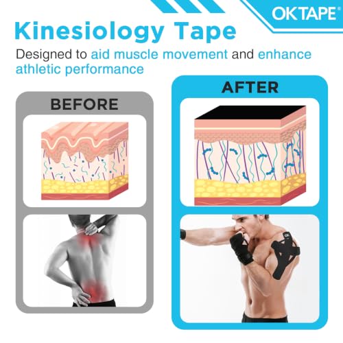 OK TAPE 100Pcs Precut Kinesiology Tape Strips, Elastic Athletic Tape - color: Black