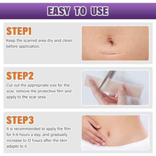 Silicone Scar Sheets, Medical Grade Silicone Scar Tape for Old & New Scars - size: 4M