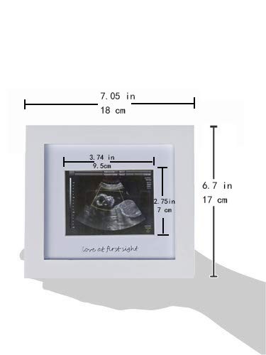IHEIPYE Baby Sonogram Photo Frame Ultrasound Picture Frame White - color: White with Silver Text, size: Single Opening - 1 Pack