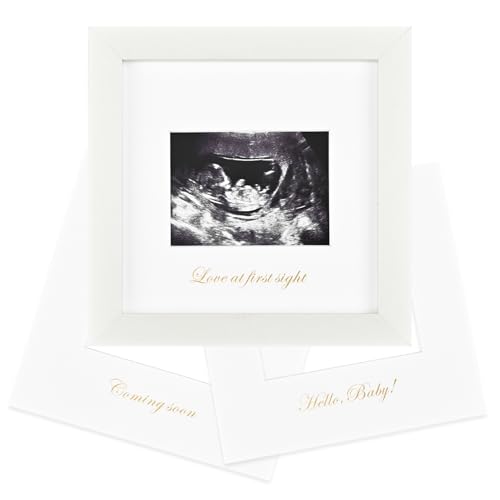 KINLINK Baby Sonogram Picture Frame, Ultrasound Picture Frame White - color: White, size: 6x6