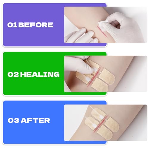 10Ct Mini Zip Stitch Delicate Facial Laceration Strips - style: Lifesilv-1-8-2