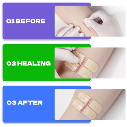 10Ct Mini Zip Stitch Delicate Facial Laceration Strips - style: Lifesilv-1-8-2
