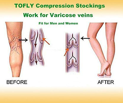 TOFLY 20-30mmHg Open Toe Compression Socks for Women & Men - color: 20-30mmhg Open-toe Black, size: 3X-Large