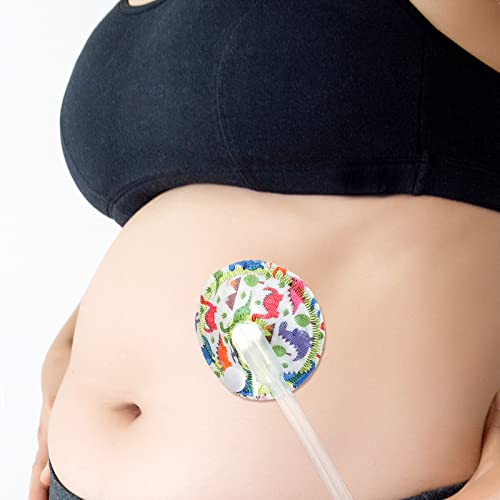 Breling 24 Pack G Tube Pads Cotton Button Covers for Care