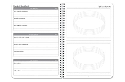 BookFactory Pregnancy Journal, Wire-O, 100 Pages