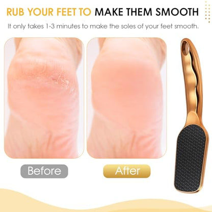 Nano-Glass Foot File Gold, Ergonomic Handle Foot Care Tool - color: Gold