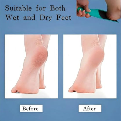 U-Shaped Curved Foot File Dead Skin Callus Remover Scrubber