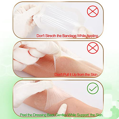NeuHeils Transparent Film Dressing, 2 3/8x2 3/4 Inch, 100 Pack, Waterproof - size: 2 3/8" x 2 3/4"