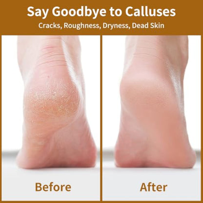Nano Glass Foot File, Double-Sided Foot Callus Remover for Cracked Heels - color: Black