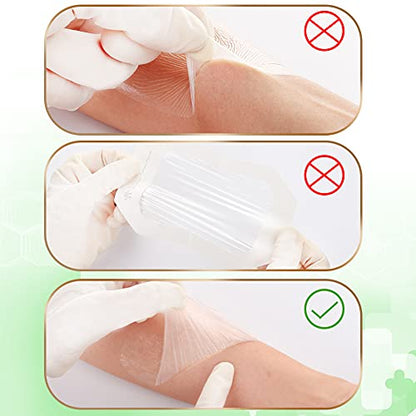 NeuHeils Transparent Film Dressing Large 4x4.75 Inch, 50 Pack, Waterproof - size: 4" x 4 3/4"