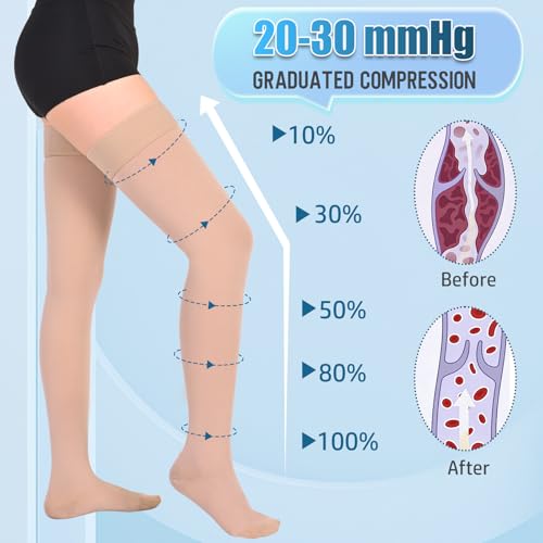 Athbavib 20-30 mmHg Thigh High Compression Stockings for Women Men - color: Closed Toe-Beige, size: Small