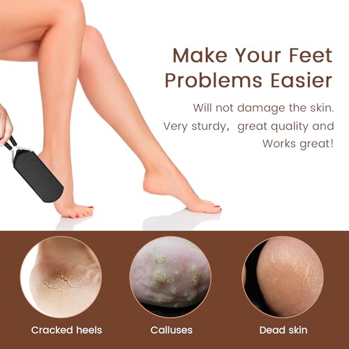 Colossal Foot Rasp Scraper - Callus Remover Detachable Big Hole - size: 1 Count (Pack of 1), style: Big Hole