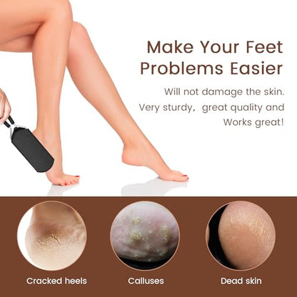 Colossal Foot Rasp Scraper - Callus Remover Detachable Big Hole - size: 1 Count (Pack of 1), style: Big Hole