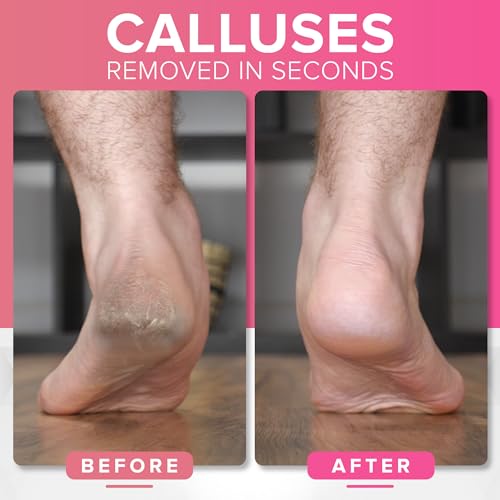 NYK1 RUSTPROOF Foot File Callus Remover for Feet | Pink - color: Pink Megafile