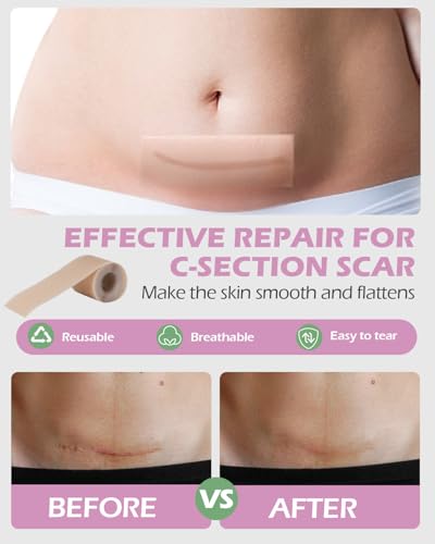 C Section Recovery Kit, Csection Postpartum Essentials