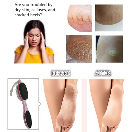 Foot Brush and Pumice Stone for Feet Scrub Callus Remover Pedicure Tools - color: Clear Pink Clear Pink