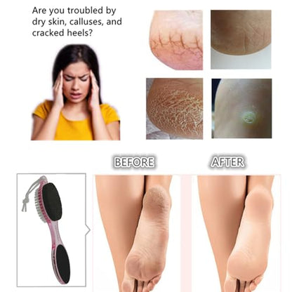 Foot Brush and Pumice Stone for Feet Scrub Callus Remover Pedicure Tools - color: Clear Pink Clear Pink