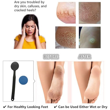 Long Handle Nano Glass Foot File Callus Remover, 2-in-1 Foot Scrubber, Hard & Dead Skin Remover, Double Sided Pedicure Tool Scraper with Sand Paper for Soft and Smooth Feet, Clear Black - color: Clear Black