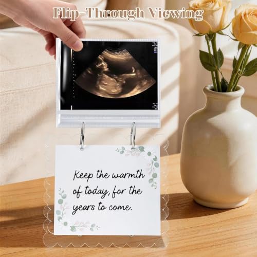 Ultrasound Pregnancy Memory Book, Scalloped Acrylic 3x4 Sonogram Album - color: Transparent 1
