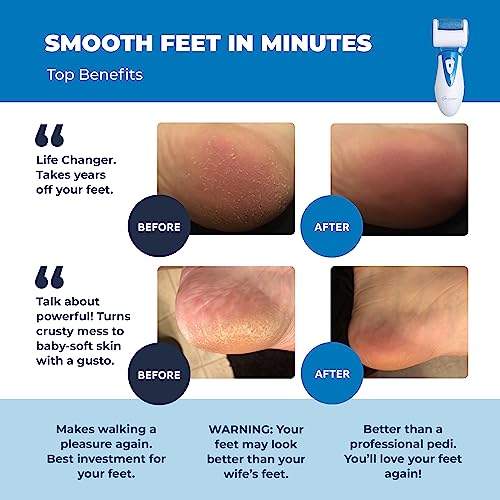 Own Harmony Electric Foot Callus Remover - Rechargeable Pedicure File Tool - color: Blue