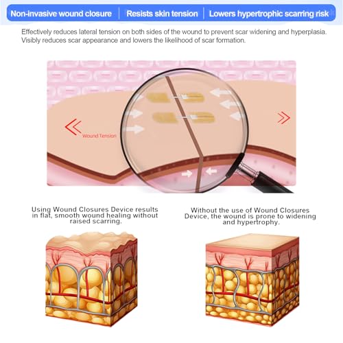 10Ct Mini Zip Stitch Delicate Facial Laceration Strips - style: Lifesilv-1-8-2