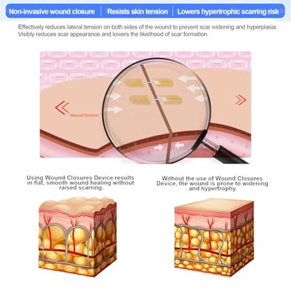 10Ct Mini Zip Stitch Delicate Facial Laceration Strips - style: Lifesilv-1-8-2