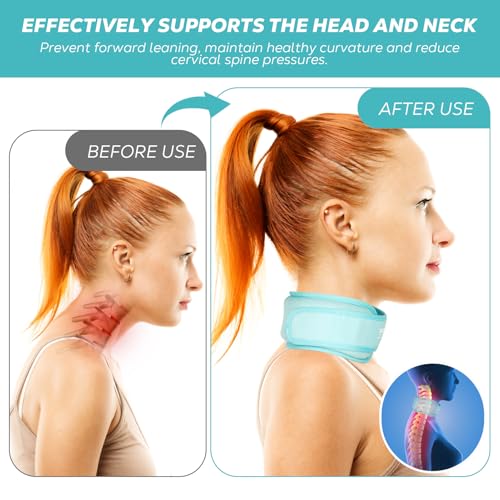 Neck Ice Pack Wrap, Reusable Cold/Hot Gel for Neck Pain, Icebluex2 - color: Iceblue+iceblue