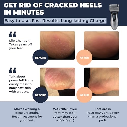 Own Harmony Electric Foot Callus Remover - Rechargeable Pedicure File Tool - color: Gray