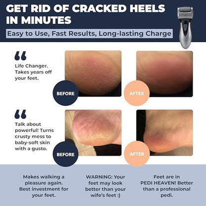 Own Harmony Electric Foot Callus Remover - Rechargeable Pedicure File Tool - color: Gray