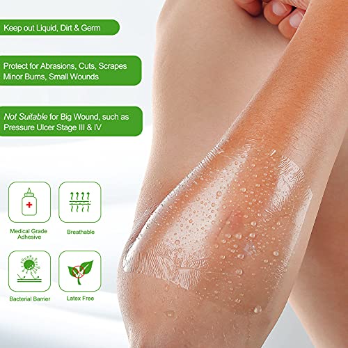 NeuHeils Transparent Film Dressing, 2 3/8x2 3/4 Inch, 100 Pack, Waterproof - size: 2 3/8" x 2 3/4"