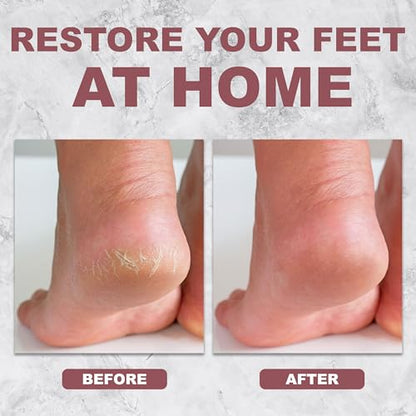 Pink Callus Remover Tool - Professional Foot File & Callus Shaver for Feet - color: Pink