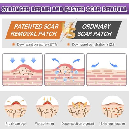 Silicone Scar Sheets, Medical Grade Silicone Scar Tape for Old & New Scars - size: 4M