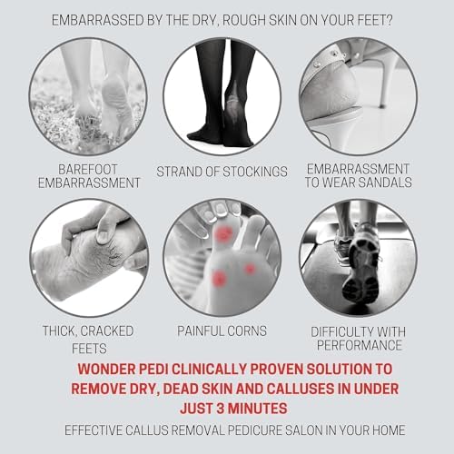 Feet Callus Remover Softener Spray, Gentle Fast-Acting Formula