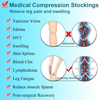 Medical Thigh High Compression Socks 20-30 mmHg for Women,Open Toe - color: Open Toe Black, size: Large