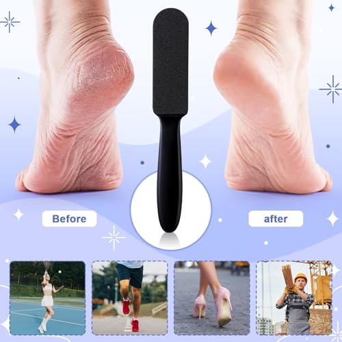 Mudder 2 Pack Pedicure Foot Files with 20 Replaceable Refill Pads,Black - color: Black