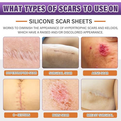 Silicone Scar Sheets, Medical Grade Silicone Scar Tape for Old & New Scars - size: 4M