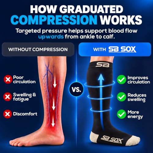 SB SOX Compression Socks for Men & Women (20-30mmHg) - color: Black/Beige, size: Small