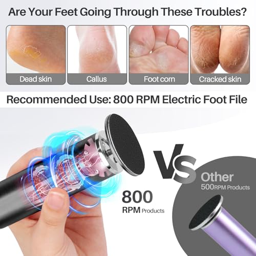 Foot File Callus Remover for Feet: Profesional Pedicure Tool for SPA - style: Black