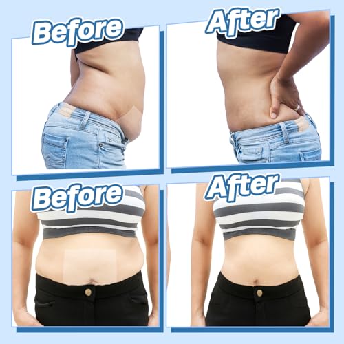 30 Pieces Tummy Lift Tuck Tapes for Women - style: Rectangle