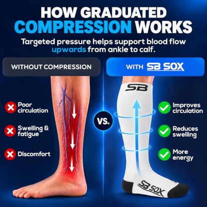 SB SOX Compression Socks for Men & Women (20-30mmHg) - color: White/Black, size: Small