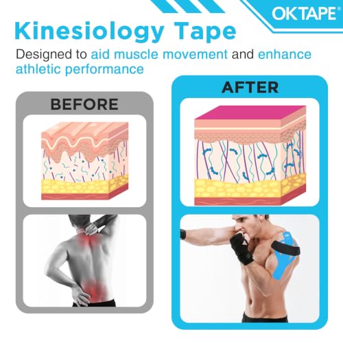 OK TAPE 100Pcs Precut Kinesiology Tape Strips, Elastic Athletic Tape - color: Mixed