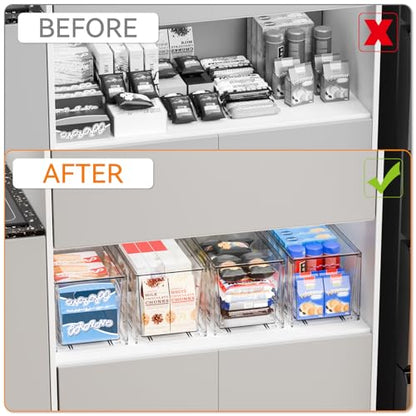 Yieach 2 Pack Large Stackable Storage Drawers,11″Deep Under Cabinet Organizer,Baby Bottle Organizer,Clear Stacking Pull Out Drawer,Acrylic Storage Containers Bins for Organizing Snack,Medicine,Makeup