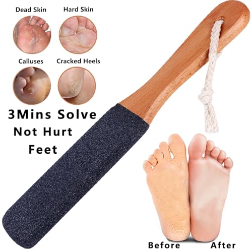 Kinepi Foot File & Foot Scrubber,Pumice Stone for Feet Callus Remover - color: Black