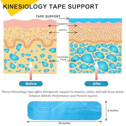 3 Pack Kinesiology Tape Precut, 60 Athletic Strips for Knee & Shoulder - color: Blue